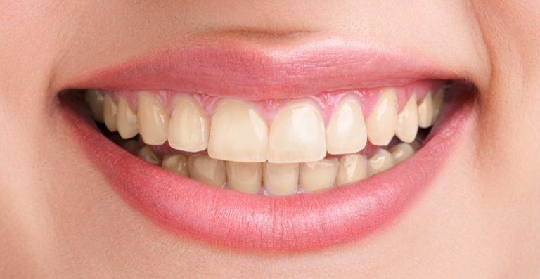 healthyteethandsmile-over-2-768×397 healthyteethandsmile-over-2-768x397